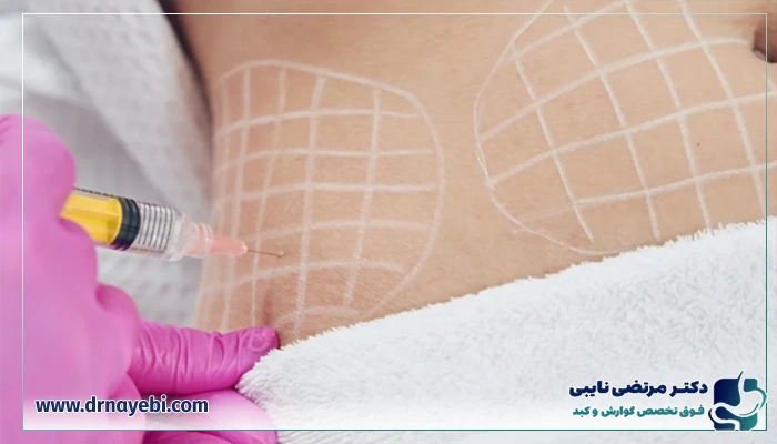 نکات مهم قبل از بوتاکس معده