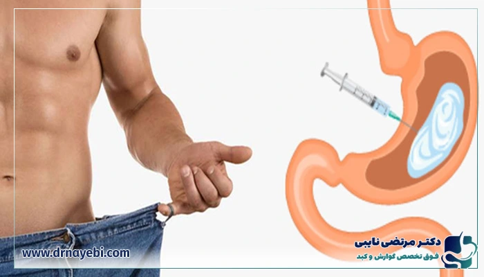 مزایای بوتاکس معده
