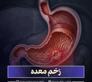 زخم معده چیست؟