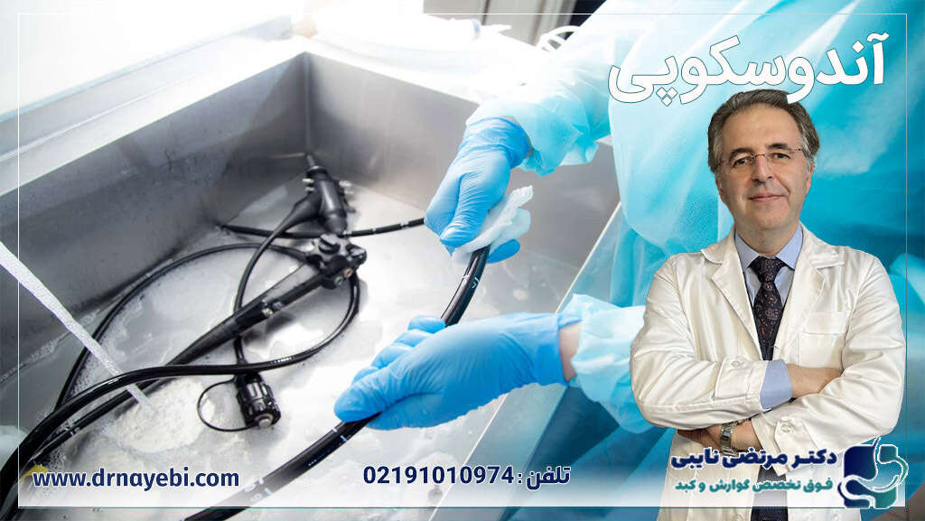 آندوسکوپی