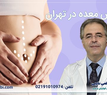 بوتاکس معده در تهران