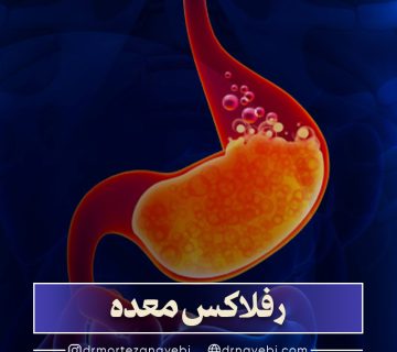 رفلاکس معده