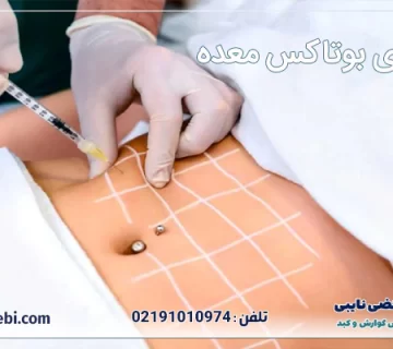 ماندگاری بوتاکس معده
