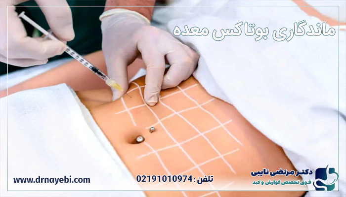 ماندگاری بوتاکس معده