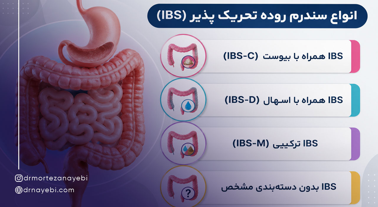 انواع سندرم روده تحریک پذیر (IBS)