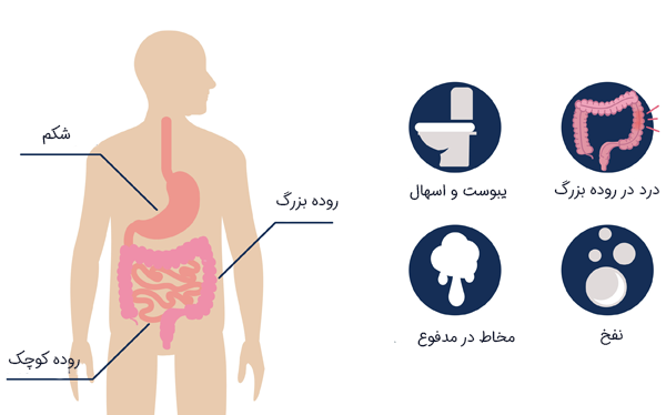 علائم سندرم روده تحریک پذیز
