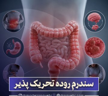 سندرم روده تحریک پذیر (IBS) چیست؟
