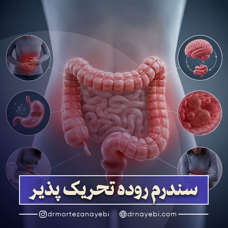 سندرم روده تحریک پذیر (IBS) چیست؟