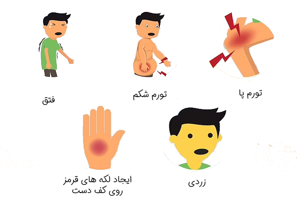 علائم کبد چرب