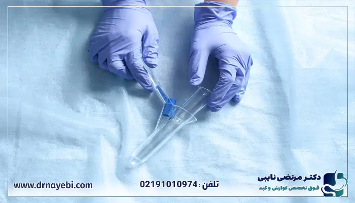 آمادگی های قبل از رکتوسکوپی