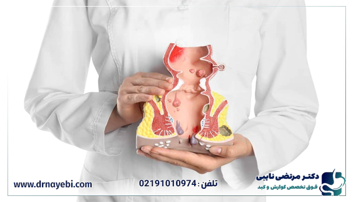 نتیجه آزمایش رکتوسکوپی