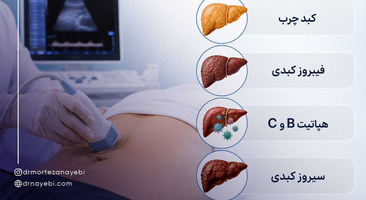 فیبرو اسکن برای چه بیماری‌هایی انجام می‌شود؟