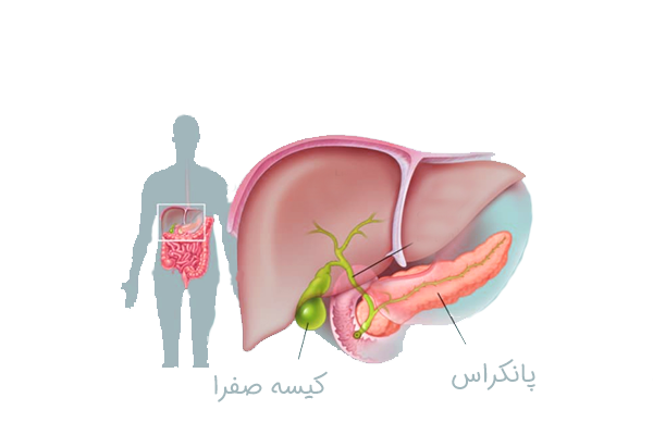 کیسه صفرا