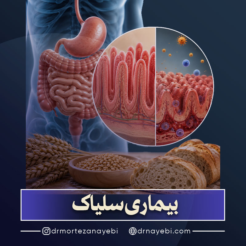 بیماری سلیاک چیست؟