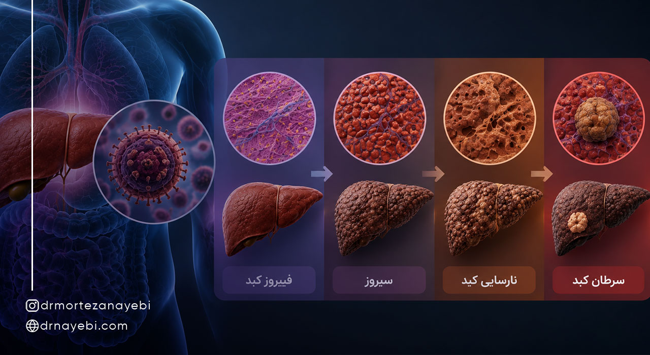 چه کسانی به درمان هپاتیت B نیاز دارند؟