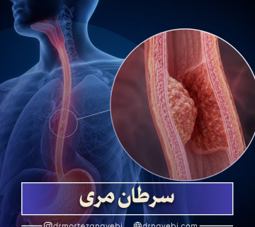 سرطان مری چیست؟