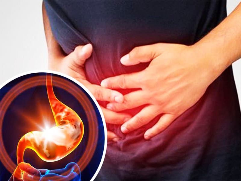 ترش کردن معده و علل آن