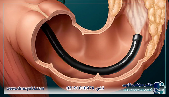 چرا کولونوسکوپی بهترین راه تشخیص بیماری های گوارشی است؟