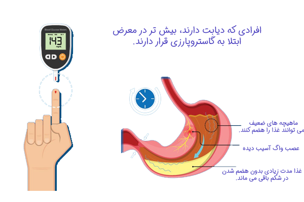علل ابتلا به گاستروپارزی