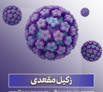 زگیل مقعدی چیست؟