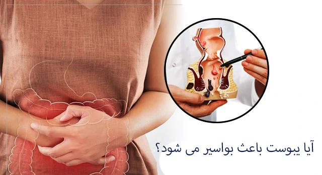 آیا یبوست باعث بواسیر می شود؟