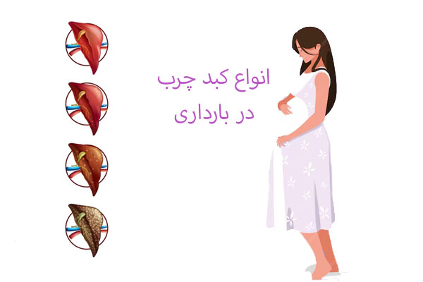 انواع کبد چرب در بارداری