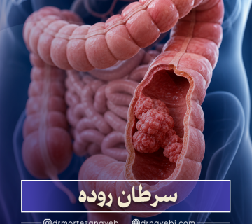 سرطان روده چیست؟