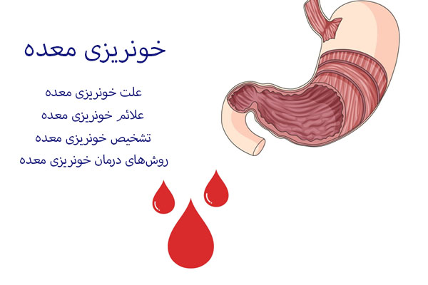 خونریزی معده