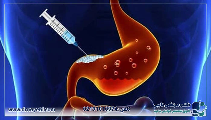 بهترین مرکز برای انجام بوتاکس معده