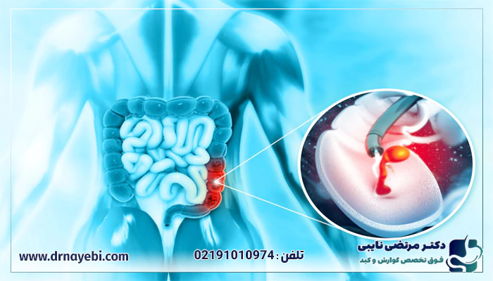 کلینیک تخصصی کولونوسکوپی در سعادت آباد