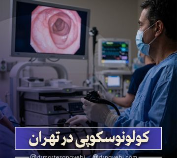 کولونوسکوپی در تهران