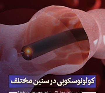 کولونوسکوپی در سنین مختلف