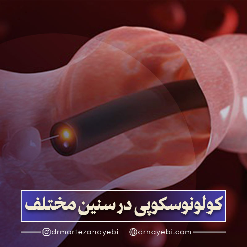 کولونوسکوپی در سنین مختلف
