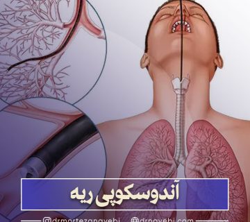 آندوسکوپی ریه