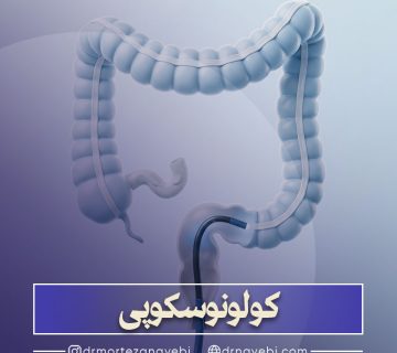 کولونوسکوپی