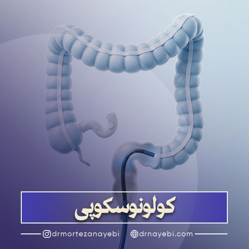 کولونوسکوپی